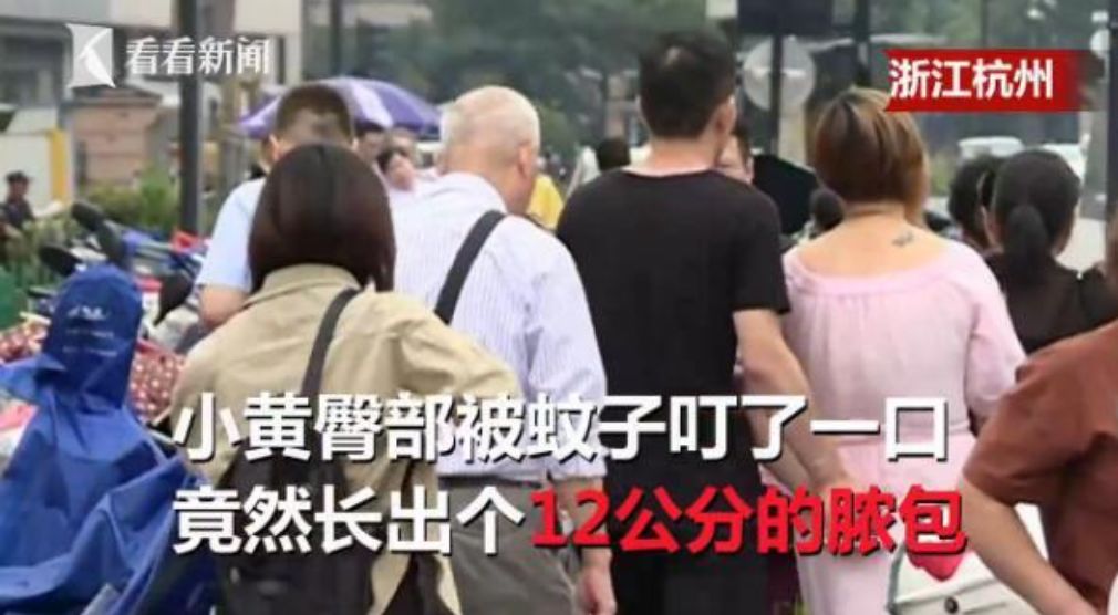 泰国防蚊虫叮咬药膏推荐,蚊子叮咬泰国青草膏哪种止痒最快