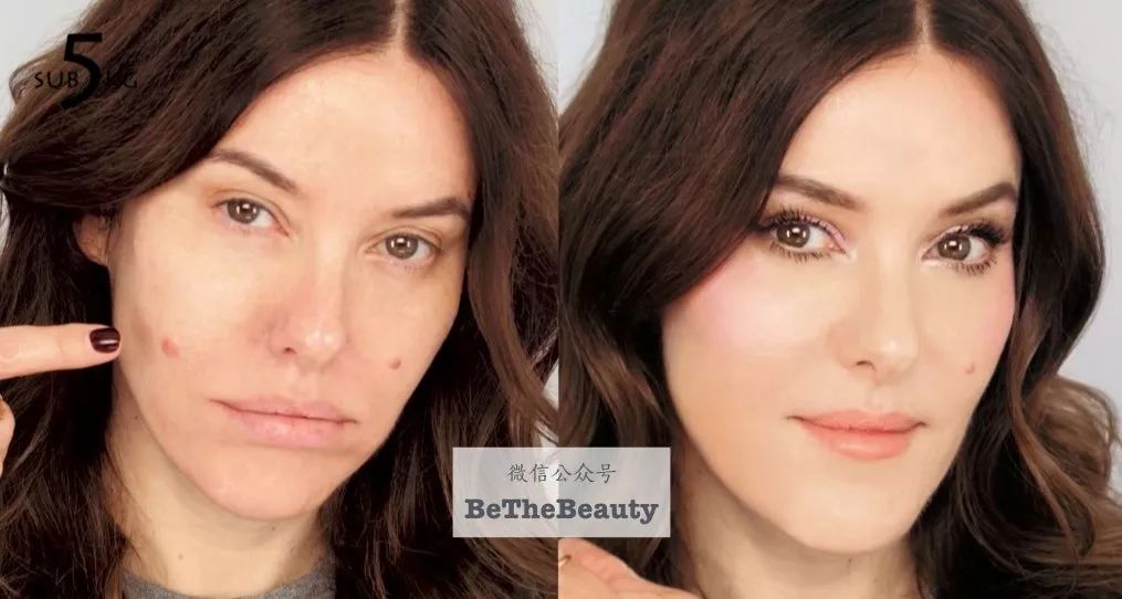 灰头土脸怎么改善,灰头土脸怎么预防