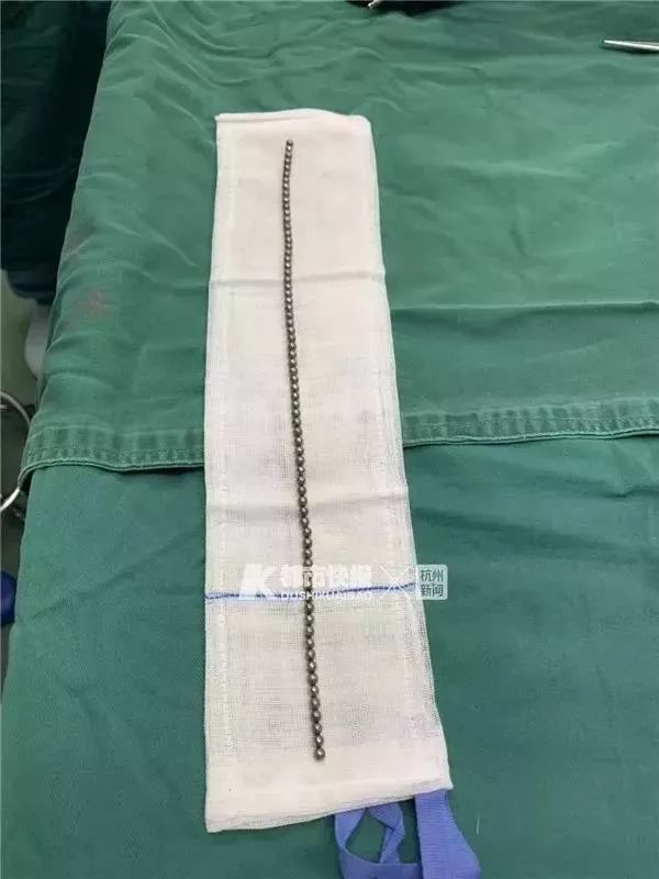 孩子呼吸出来一股恶臭味,三岁女童身体散发臭味真相