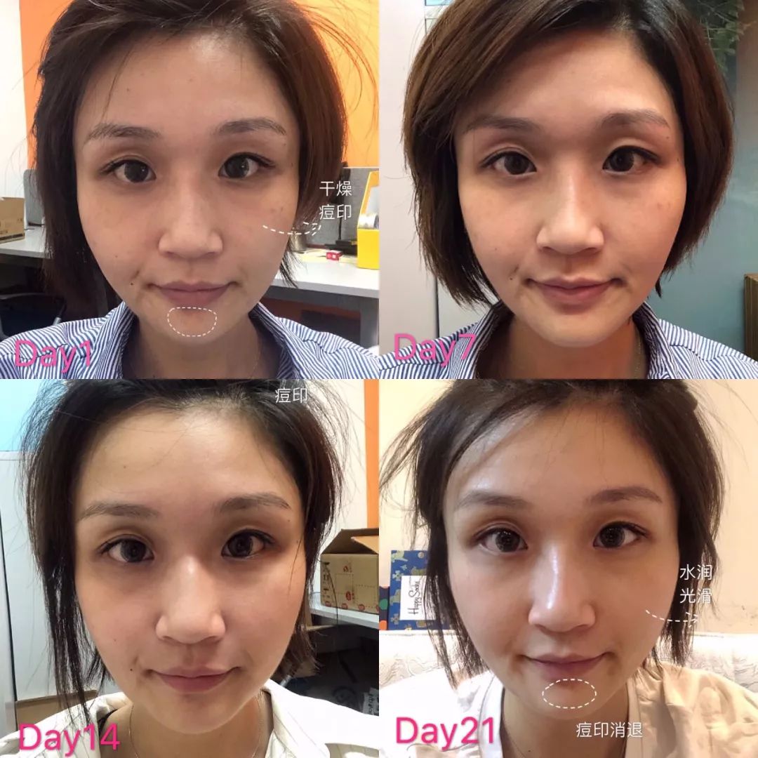 21天测试,21天测评