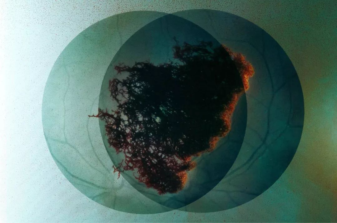 小蓝星周报|棉花棒能反复用，塑料御守守护你