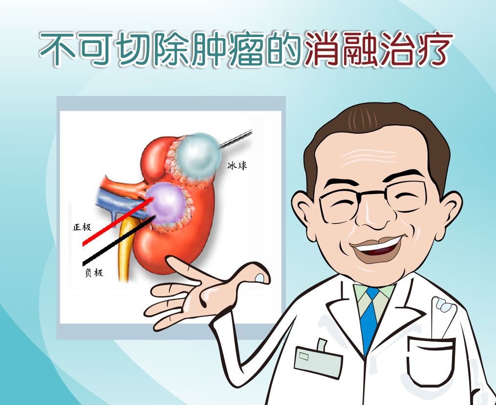 肝癌合并门静脉癌栓怎么办,纳米刀成对付癌中王的新利器
