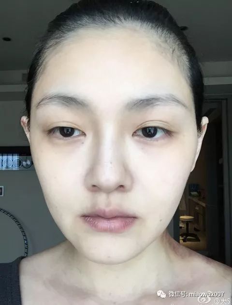 一定不要乱用面膜,奉劝大家真的别乱花钱再乱用面膜