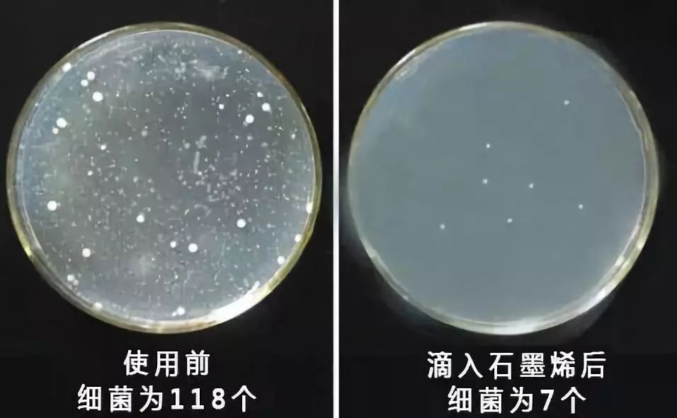 女生不注意下身卫生的危害,不注意个人卫生的表现女生