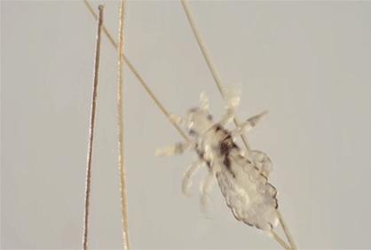 一些吸血的昆虫蜱虫,好多小虫子吸血