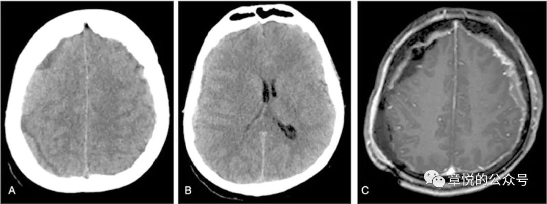 「章悦故事汇」华山“一针灵”