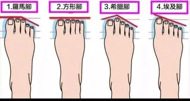 自己的脚是罗马脚还是埃及脚,罗马脚埃及脚希腊脚的区别