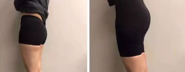 都说撒娇女人最好命是吗,都说撒娇女人最好命真是这样吗