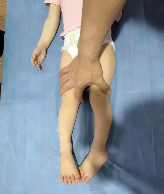 宝宝罗圈腿最佳矫正方法,罗圈腿矫正可以高几厘米