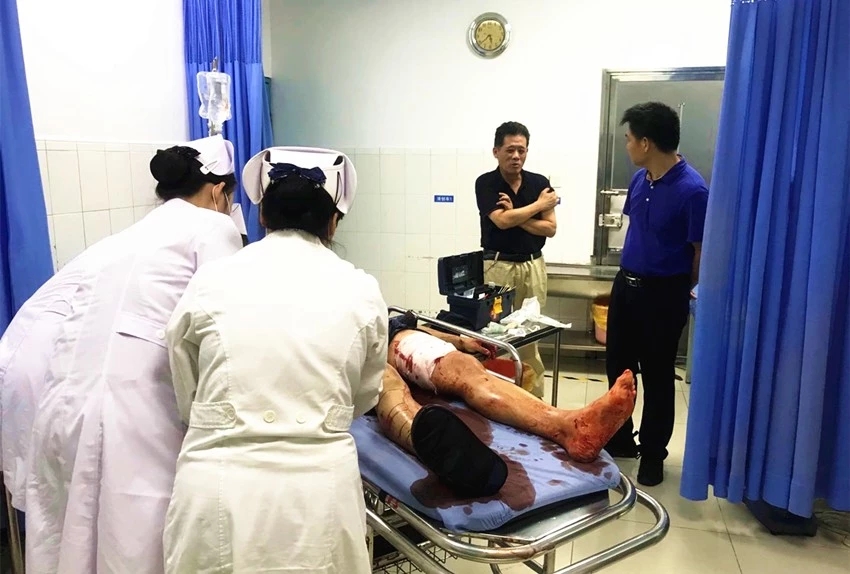 装修工失手割断动、静脉失血超3000毫升东莞“硬核”医生将其救回