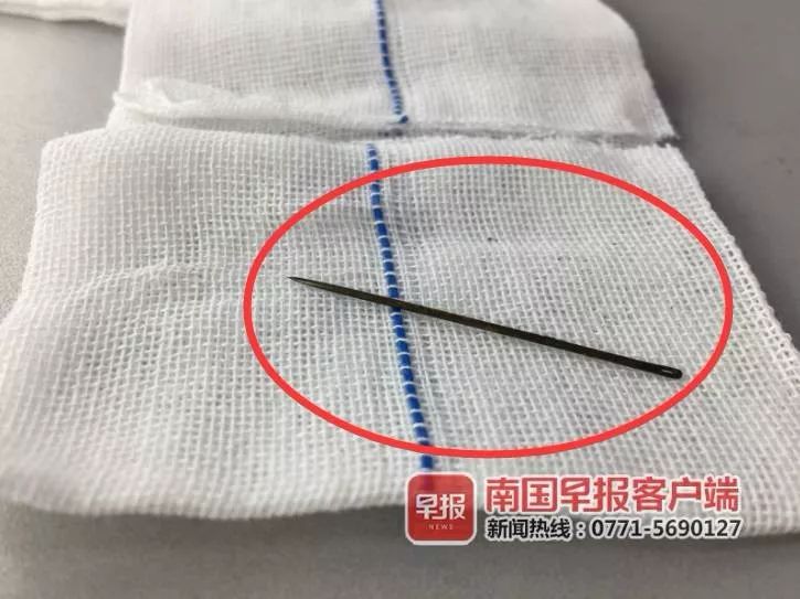 吓人！11岁男孩在家中玩耍，竟将一根4.5厘米长缝衣针塞入*体下**