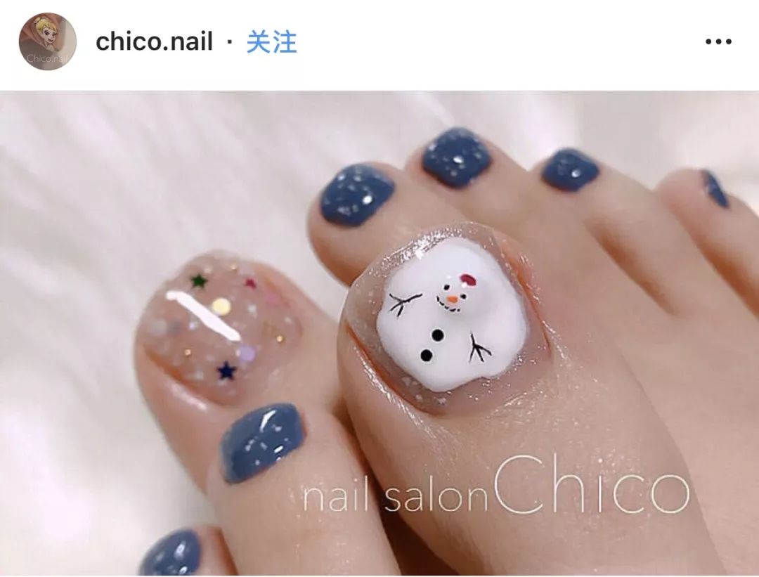 怎么治疗灰趾甲才能彻底不反复,如何快速自然地摆脱指甲真菌