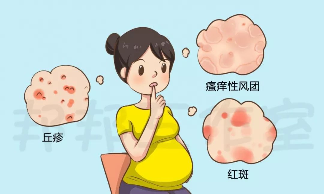 孕妇全身过敏瘙痒最快的解决办法,怀孕过敏痒痒如何快速止痒