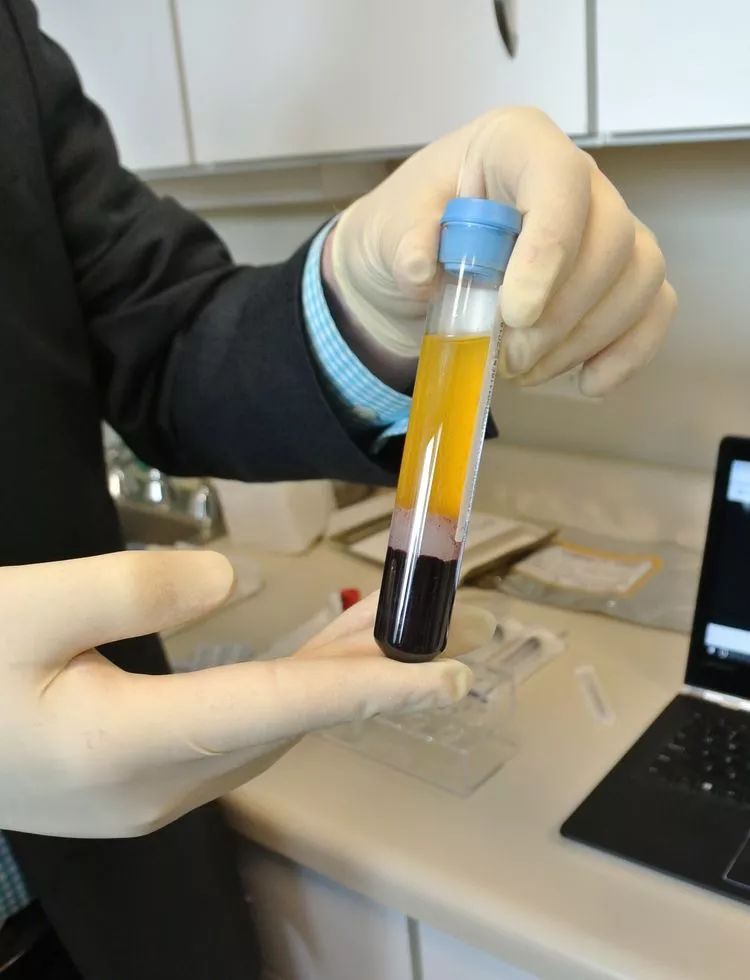 脚底注射肉毒毒素多少钱,脚底注射肉毒素的危害