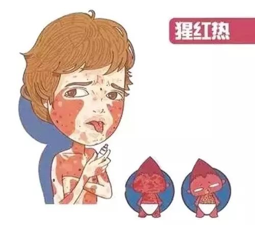 幼儿急疹和手足口病怎么治,手足口急疹荨麻疹同时出现