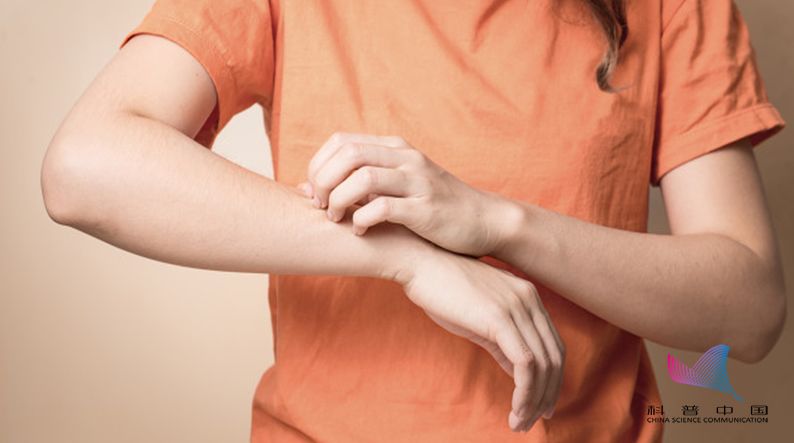 被蚊子咬了特别痒怎么快速止痒,被蚊子咬了一直很痒怎么快速止痒