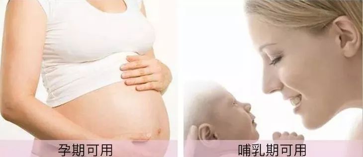 变色唇膏保湿滋润补水孕妇可用,孕期大牌变色唇膏