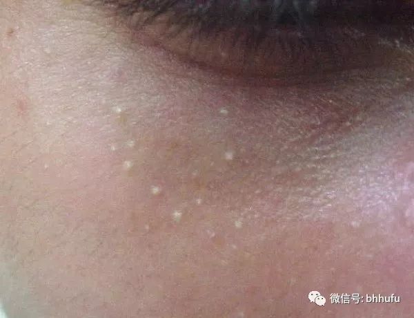 闭口看得出来吗,你真的知道什么是闭口吗