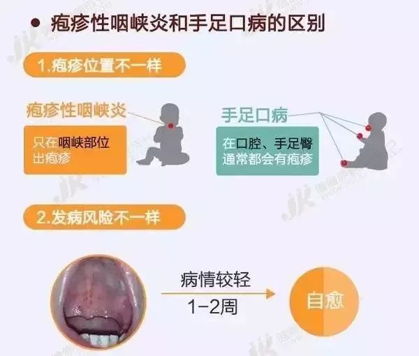 高烧引起疱疹要用什么药,高烧还有带状疱疹
