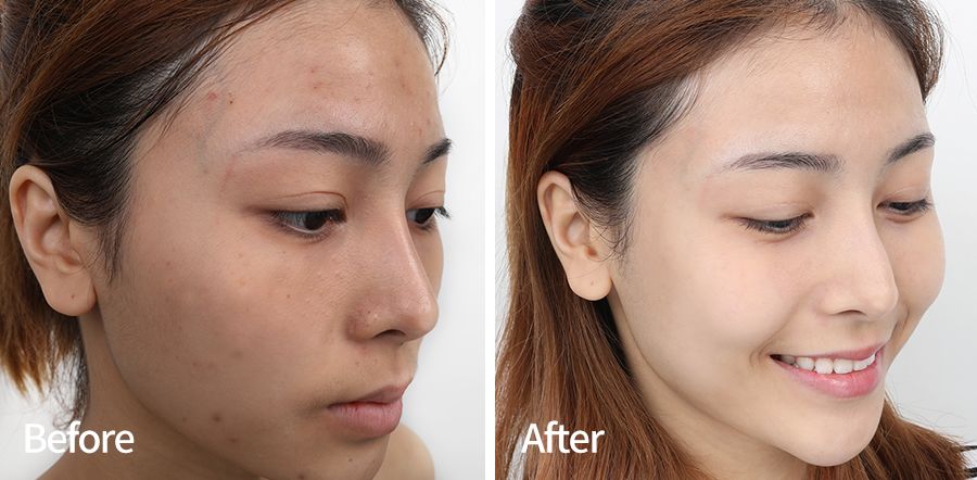 国货之光护肤品面膜,郑元畅面膜推荐