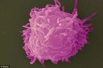 戴隐形眼镜眼睛长虫有什么症状,戴隐形眼镜把眼角膜磨坏了