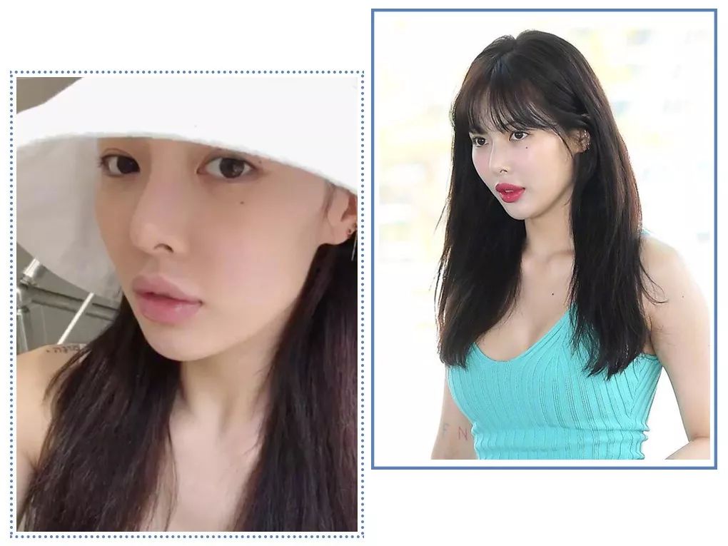 泫雅丰唇后颜值下跌?!但大家都爱这样的“香肠嘴”啊