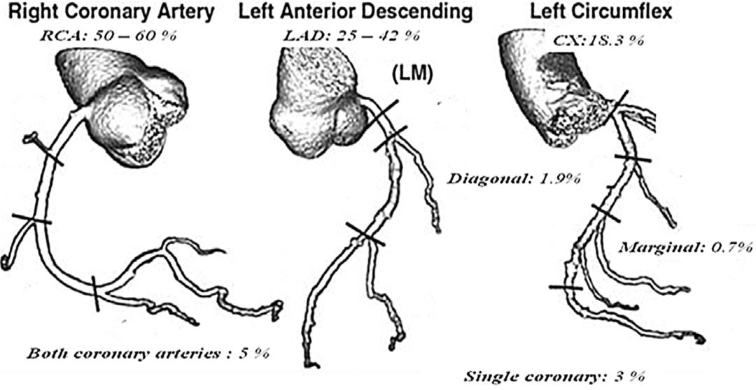 冠状动脉瘘是怎么回事,冠状动脉瘘原因