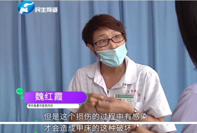 8岁男童烂指甲,8岁男童指甲烂掉