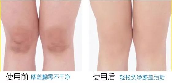 洗澡搓背神器不伤肤无痛,洗澡搓背神器去死皮深层清洁