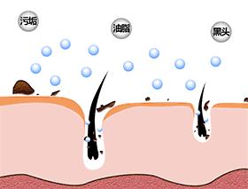 用黑头仪吸完黑头黑头还会再长吗,黑头别膨胀3招把你刷光光