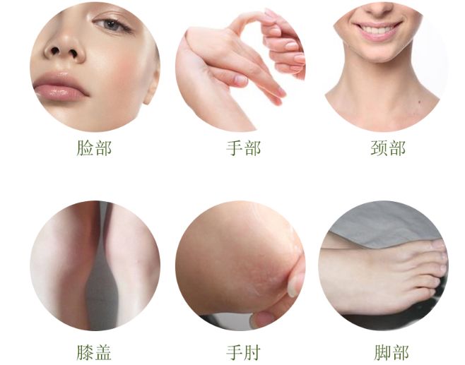 脸上搓下来很多泥,脸上搓出黑头