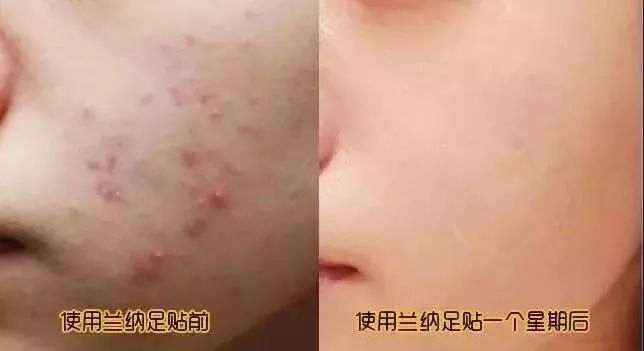 湿气重做什么动作可以排湿,湿气重吃什么药可以快速排湿