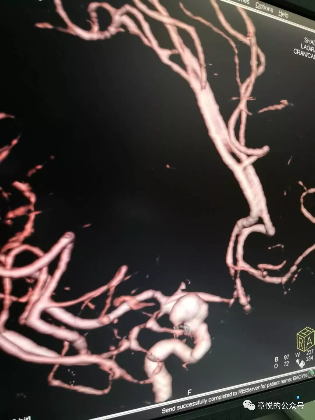 常见潜水疾病,潜水多深才会得潜水病