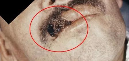 鸟屎为什么是白色的,鸟屎为什么有各种颜色