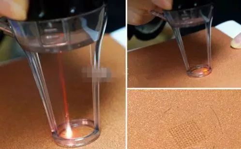 30岁脸上长痘坑怎么办,30岁长痘坑怎么修复