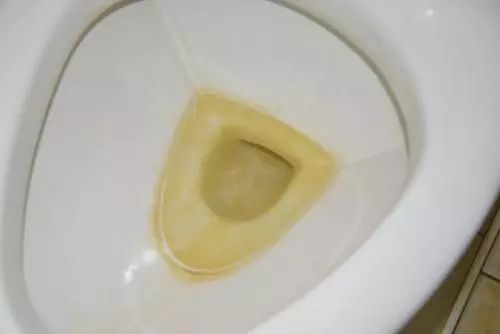 马桶特价秒杀200-300元,马桶冲水喷射大量细菌是真的吗