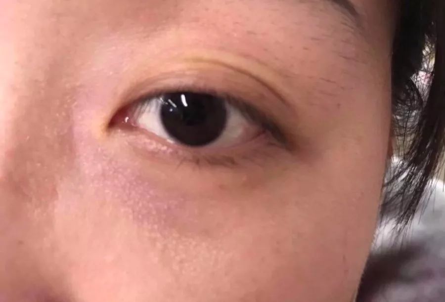 睡前一分钟做好这件事就能抗皱纹,最近比较火的淡化皱纹方法