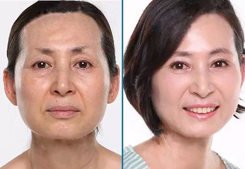 睡前一分钟做好这件事就能抗皱纹,最近比较火的淡化皱纹方法