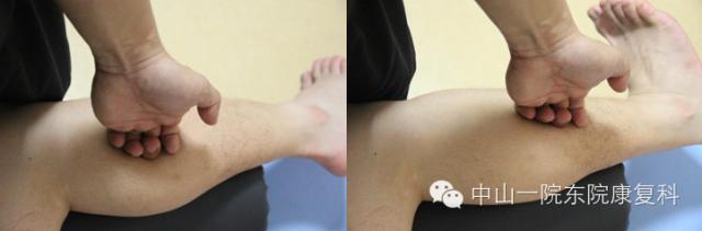 筋膜的康复训练方法,12条筋膜链解析及治疗手法