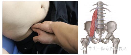 筋膜的康复训练方法,12条筋膜链解析及治疗手法