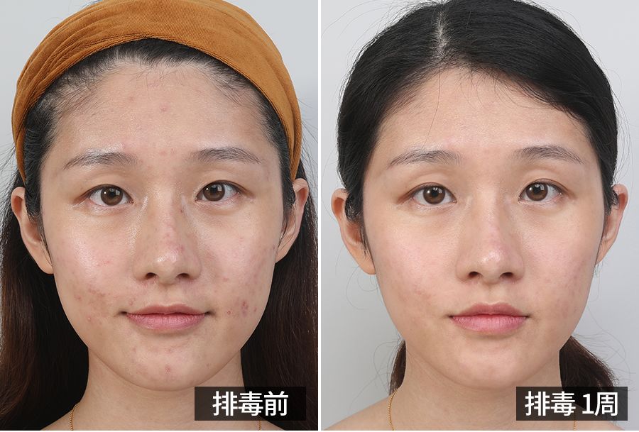 宋慧乔金喜善大长今,大长今金喜善宋慧乔