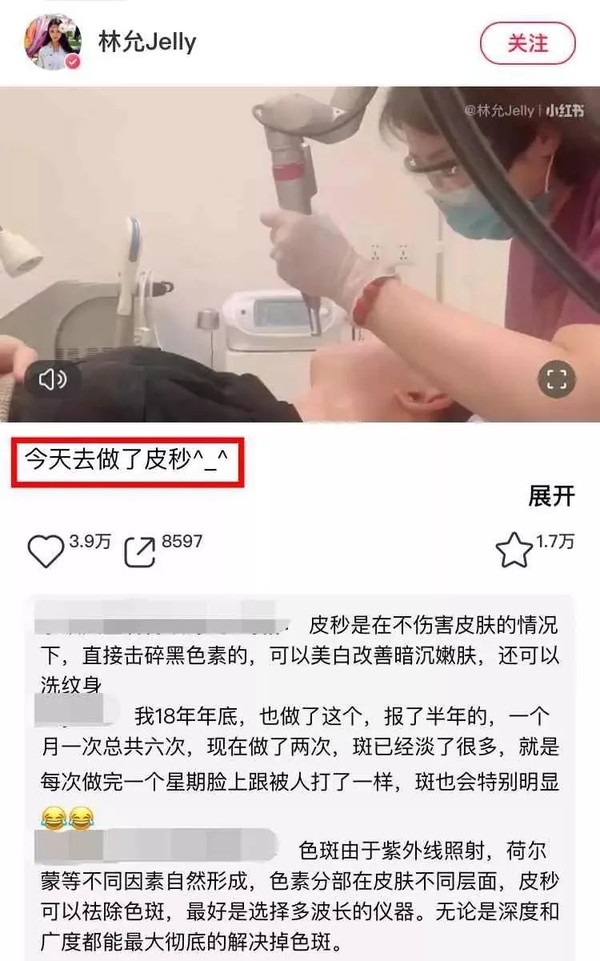 秦岚承认靠医美冻龄哪里人,秦岚承认常用医美驻颜