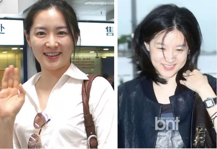 整容明星脸翻车现场,明星整容翻车名场面