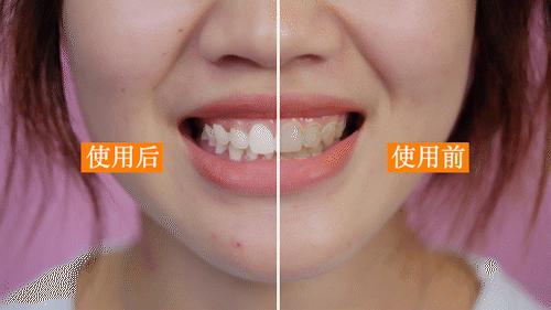 美白牙膏一刷就好,美白黄牙烟渍最好的牙膏