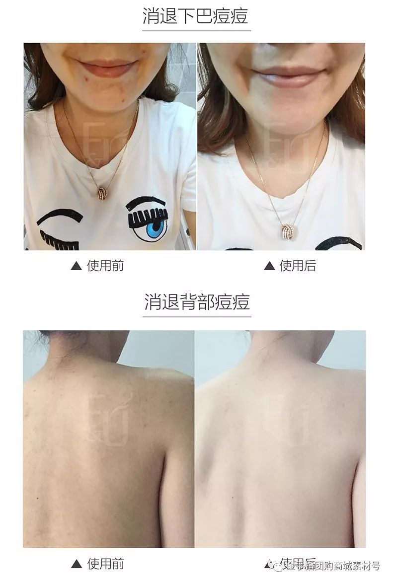 金手指团购72包,金手指抖音团购票