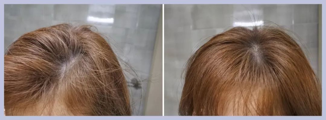 好用的蓬松头发神器,不换发型怎样让头发变好看