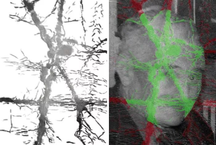原来的老照片修复一下,修复污损老照片