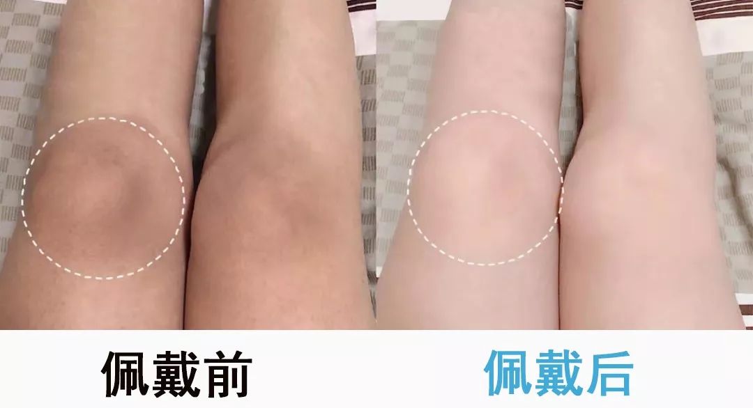 保暖护膝柔软舒适告别老寒腿,零下10度抗寒护膝