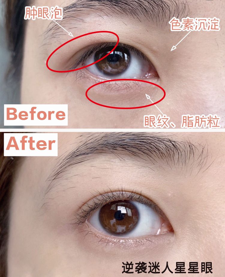 适合熬夜的护眼神器,眼睛疲劳用什么护眼神器