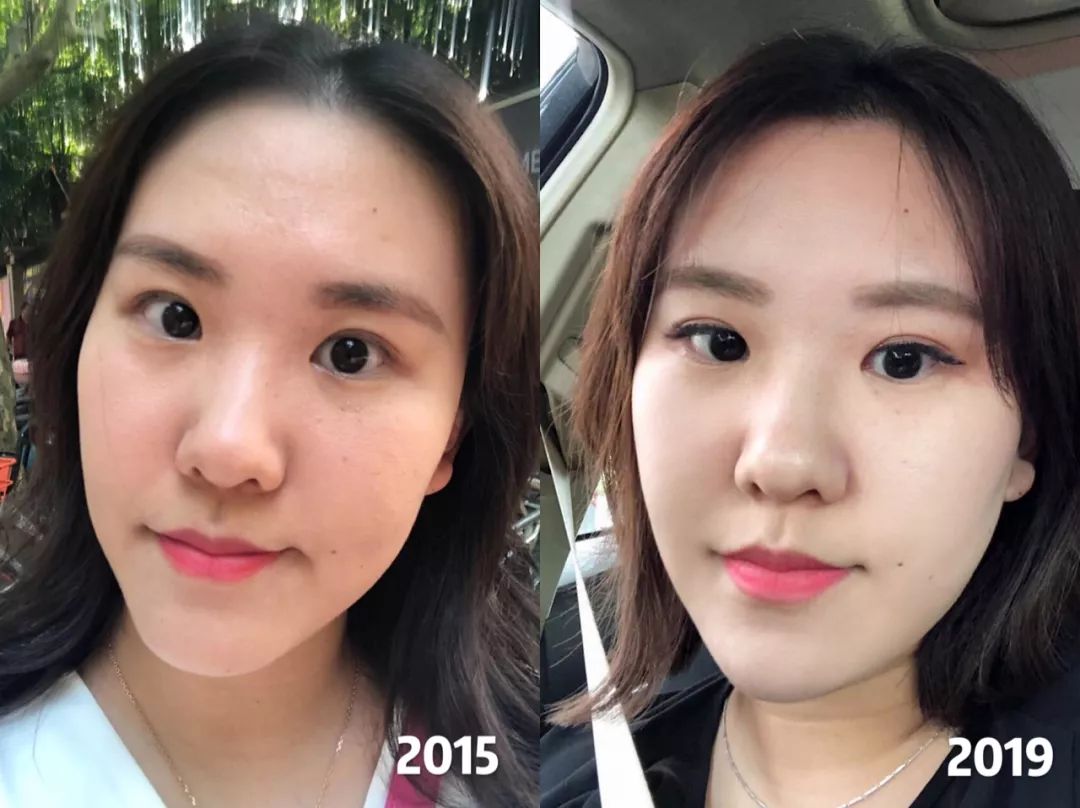 粉丝提问口服胶原蛋白真的有用吗,粉丝问坚果怎么选